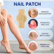 Generic Fungal Nail Patches (Yellow)